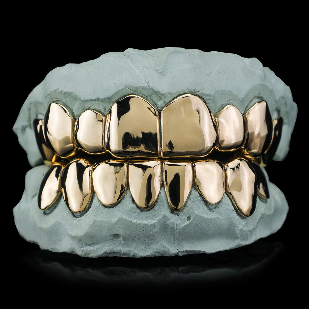 Custom Gold Grillz- Top